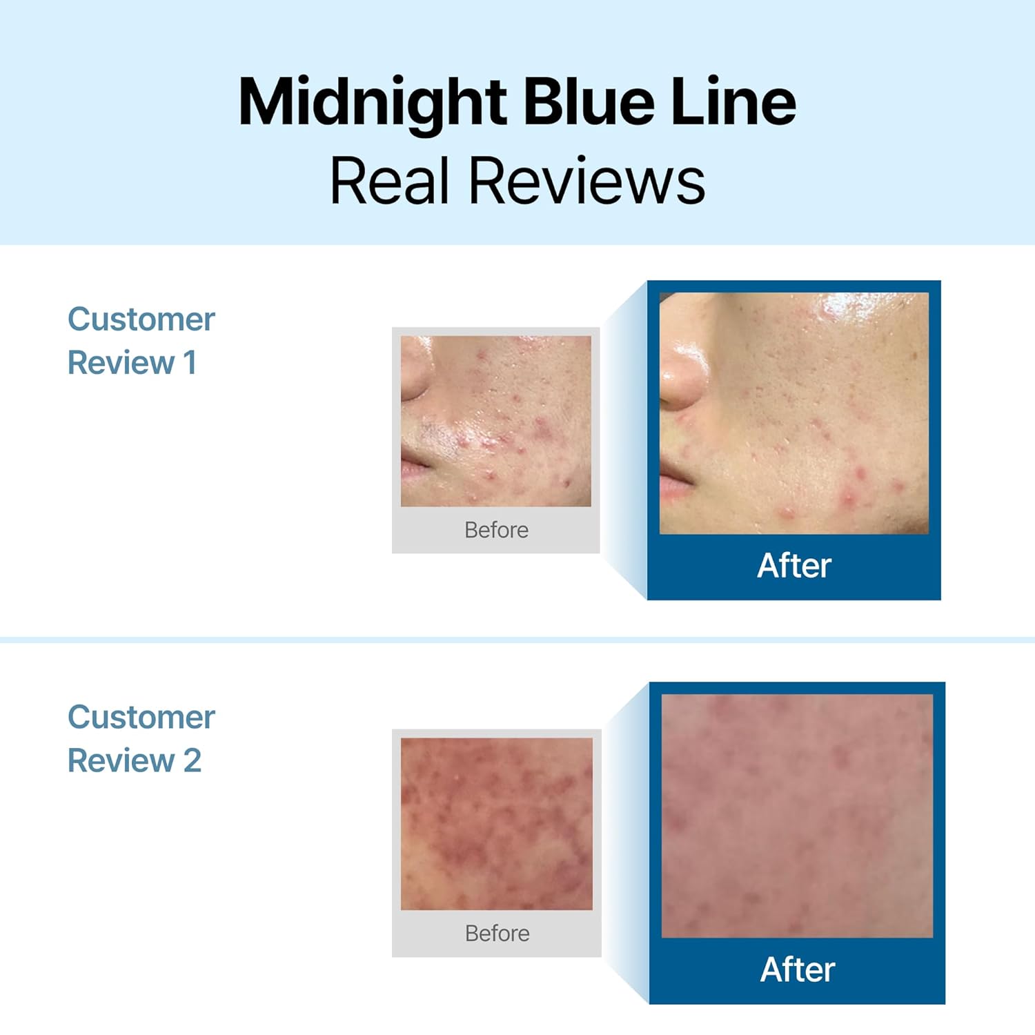 Midnight Blue Calming Cream | Lightweight redness-relieving cream for sensitive oily skin